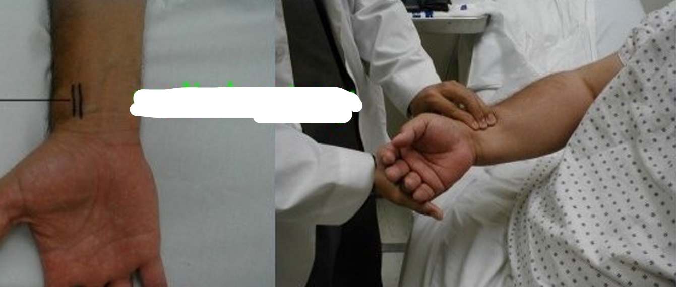 term image
