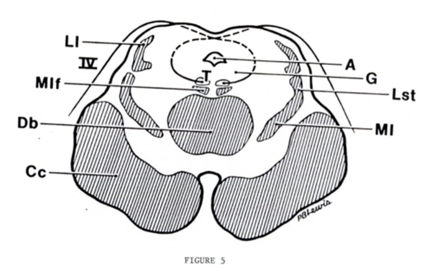 <p>inferior colliculus (dorsal surface)</p><p>exits dorsal + caudal (posteroinferior) to nucleus</p>