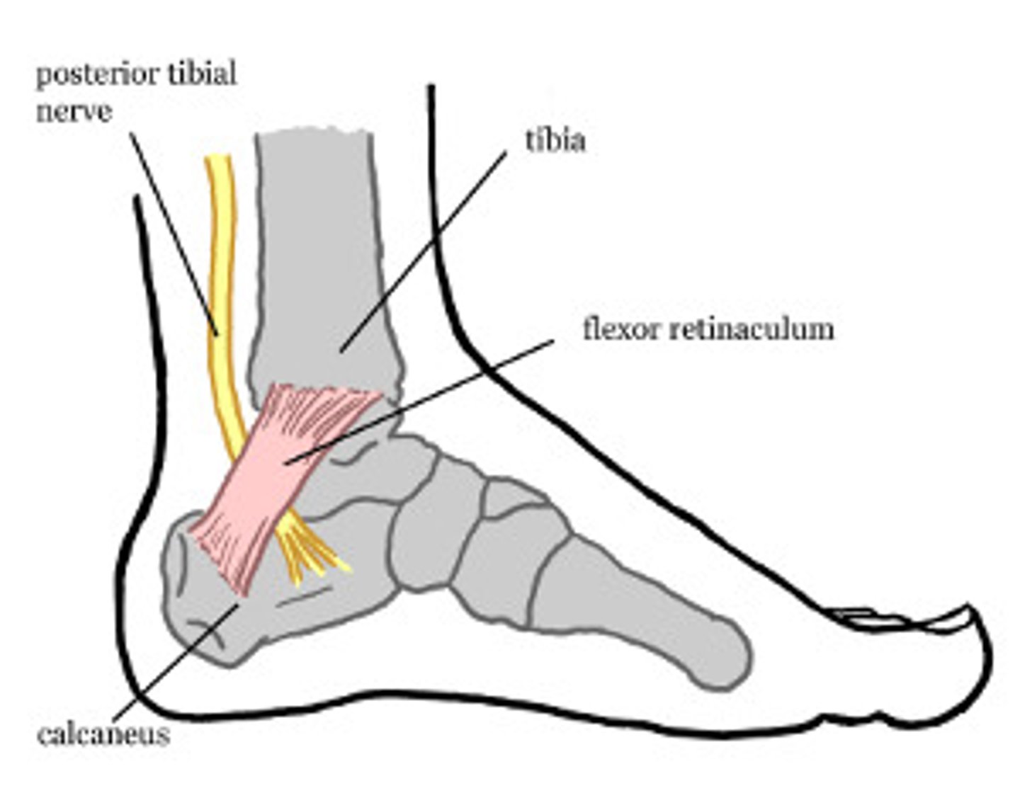 <p>age 25-50</p><p>MOI: posttraumatic, rapid weight gain, fluid retention, inflammatory, abnormal foot/ankle biomechanics or a valgus foot deformity</p><p>- symptoms on medial malleolus, distribution of posterior tibuial nerve down into the medial arch and plantar furface of foot and toes</p><p>- symptoms increase with excessive pronation in walking or runnin g</p><p>- pronated foot, pes planus can be observed</p><p>- passive plantarflexion and eversion painful</p><p>- resisted toe flexion painful</p><p>test: tinels sign positive</p>