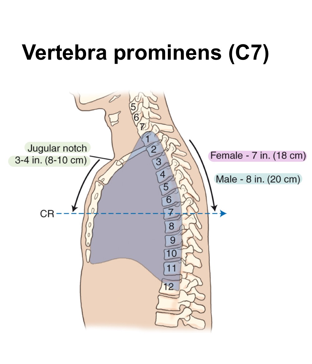<p>Palpable notch at the superior border of the manubrium; useful chest landmark.</p>