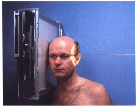 <p><span style="color: oklch(0.3039 0.04 213.68);">For the lateral projection of the sella turcica, the IR is centered 1/2 inch (1.9 cm) anterior and 1/2 inch (1.9 cm) superior to the _____________. </span></p>