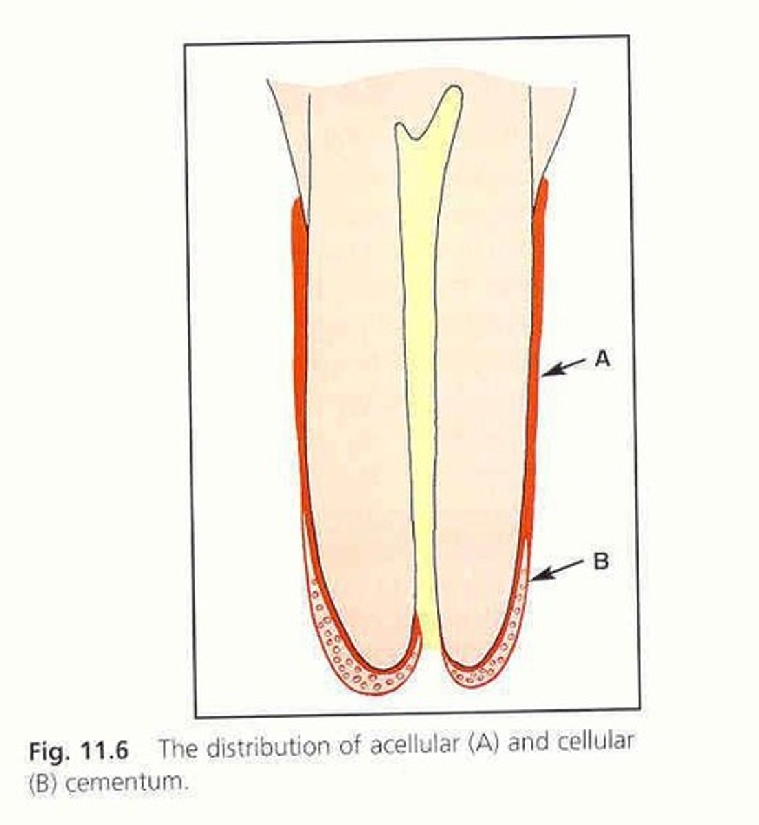 <p>The two types of cementum are acellular cementum and cellular cementum.</p>