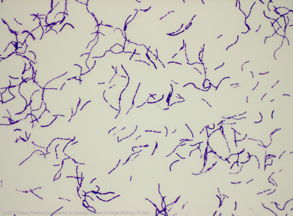 <p>what is this bacteria?</p>