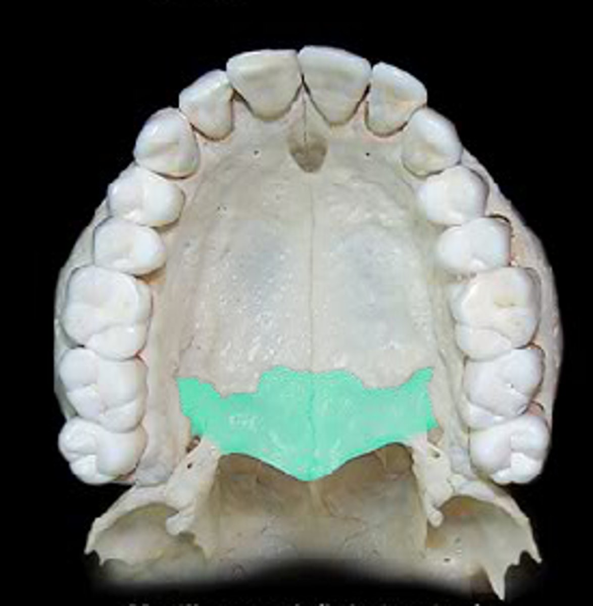 <p>forms the posterior portion of the hard palate</p>