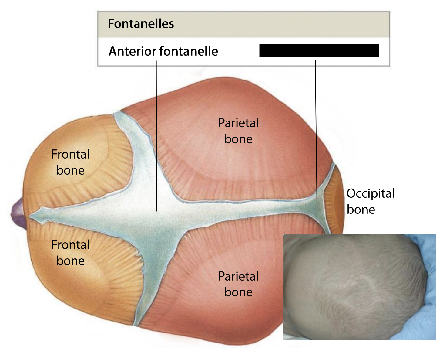 What fontanelle is this?