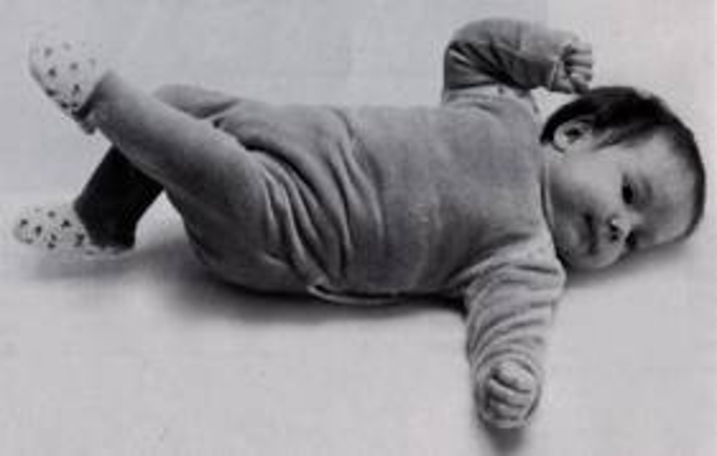 <p>When baby is lying on her back, depending on the direction of the head- that arm will straighten while the other hand raises up at the head</p>