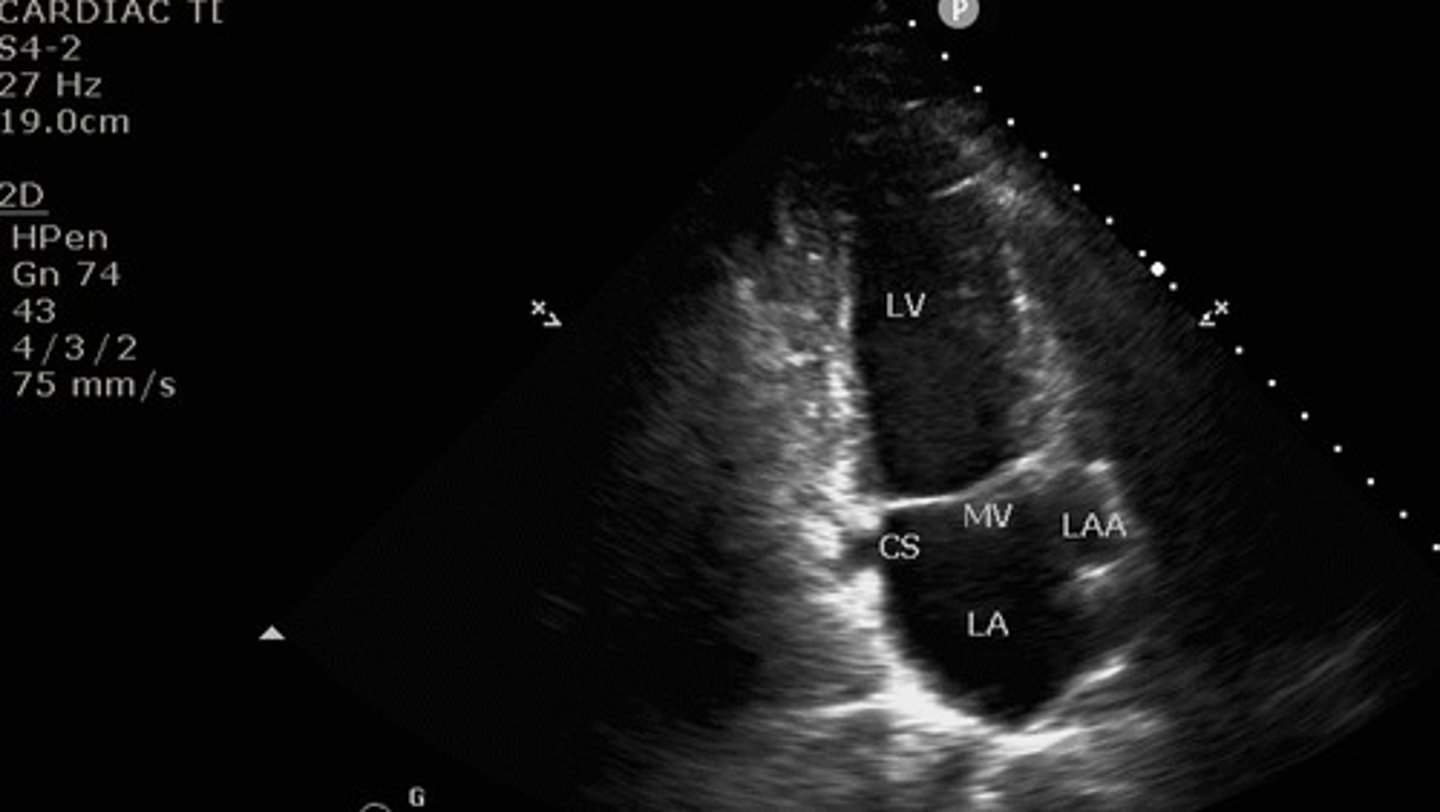 <p>what view is this</p>