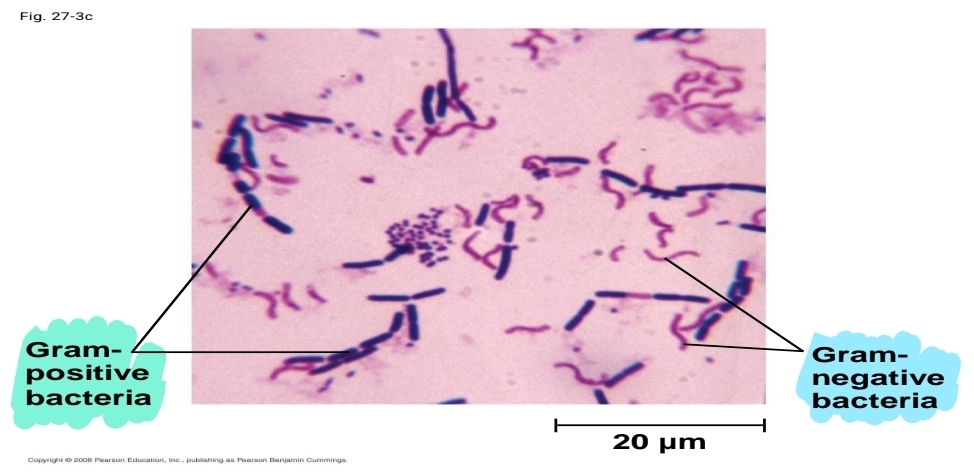 <p>what is a gram stain</p>