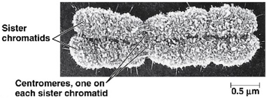 <p><span>The chromosome begins M phase looking as shown. When does it split?</span></p>