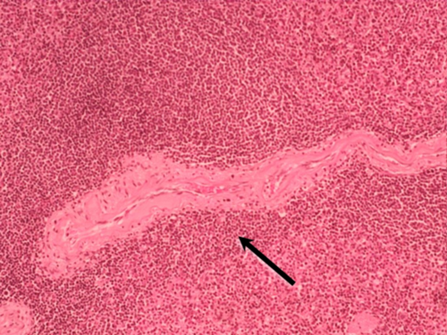 <p>black arrow PALs of red pulp of spleen</p>