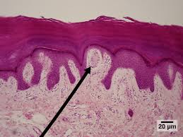 <p>Meissner’s Corpuscles </p>