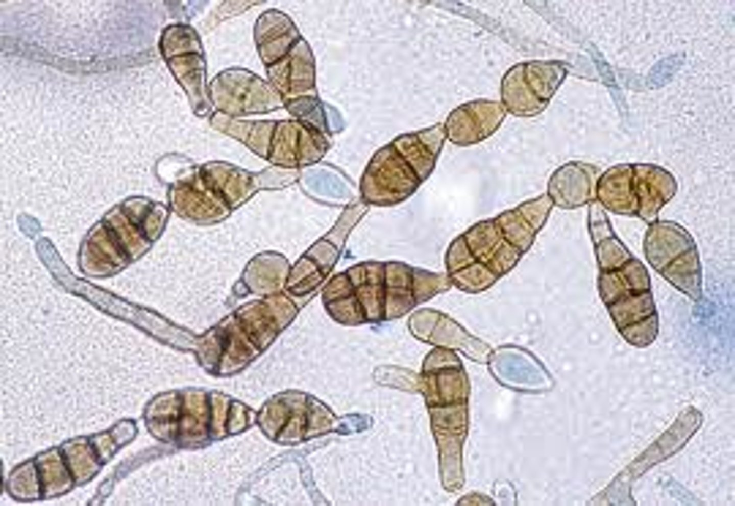 <p>• Brownish black colonies</p><p>• Chains of club-shped conidia</p><p>with transverse and longitudinal</p><p>separations</p>