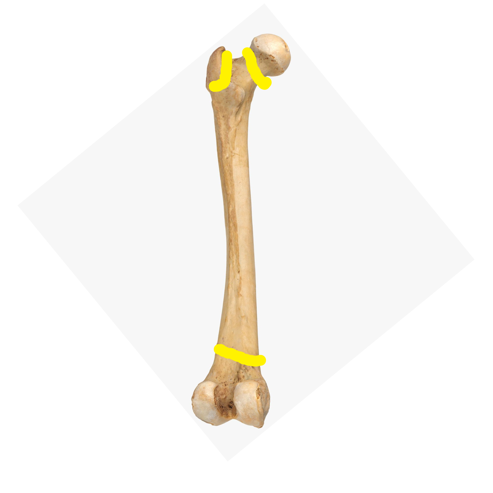 <p>Identify this bone part (________ line)</p>