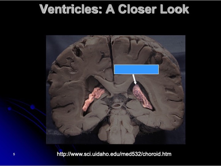 <p>which ventricles do you see? </p>