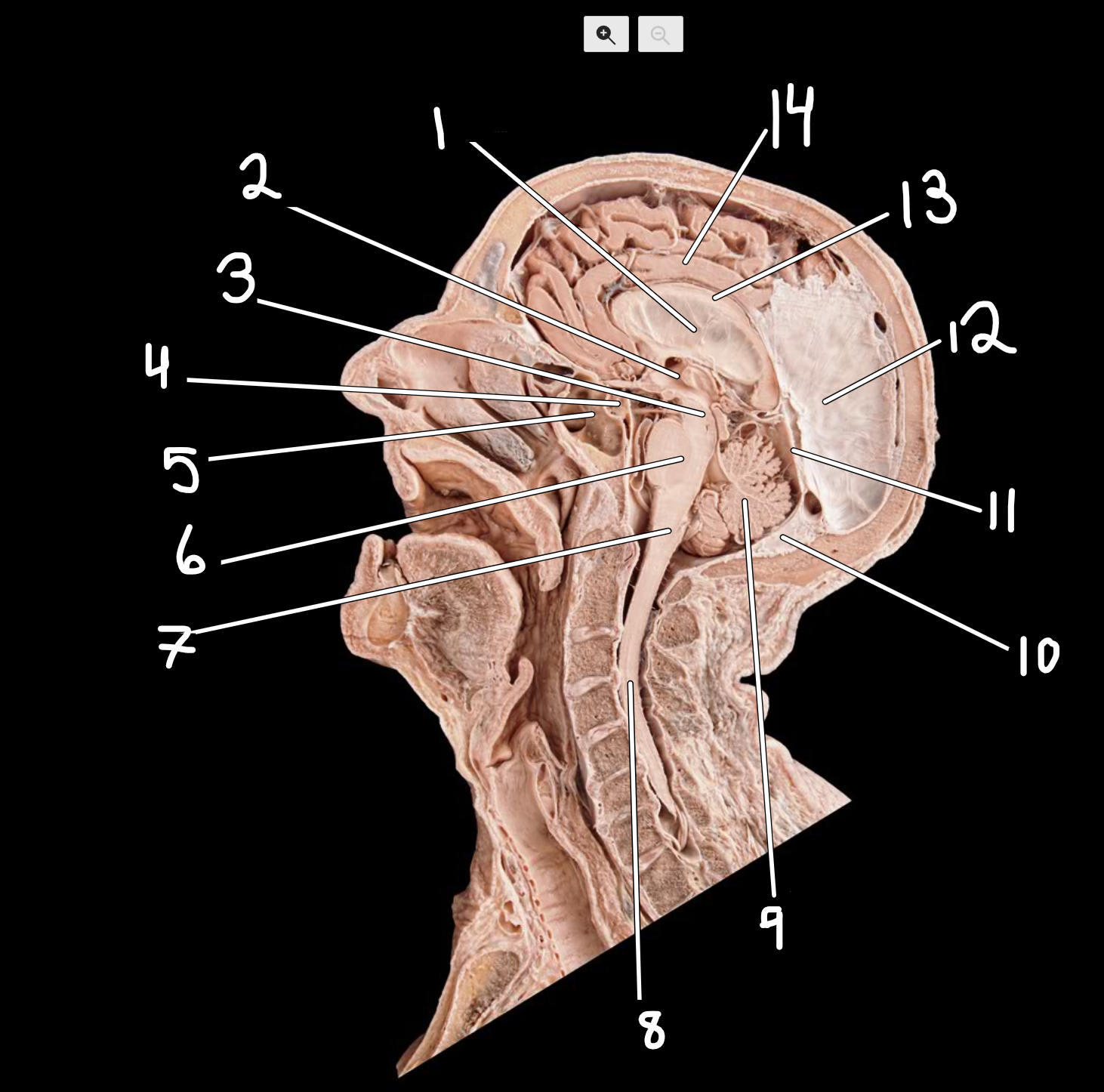 <p>Midsagittal head </p>