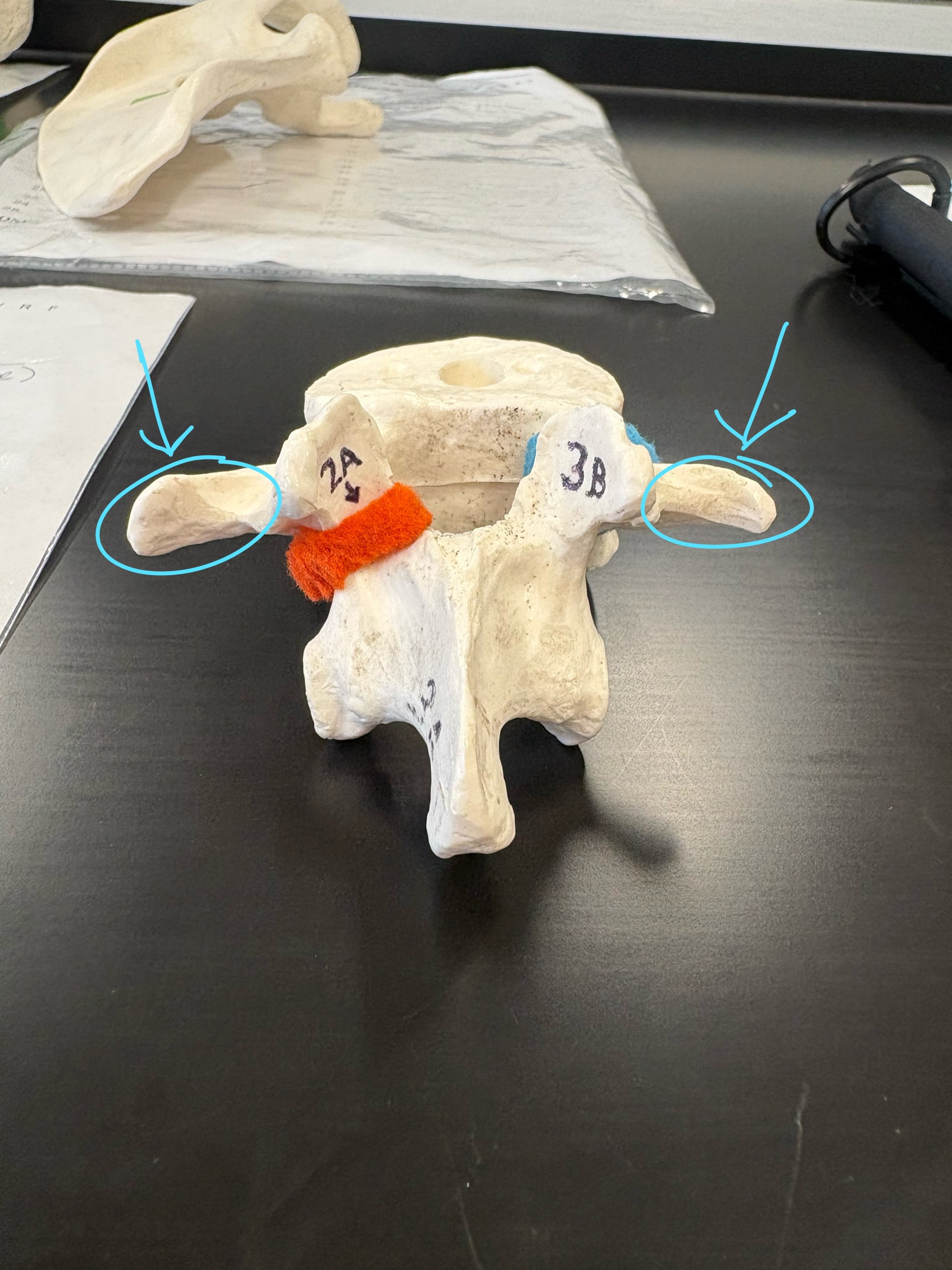 <p>Name this structure</p>