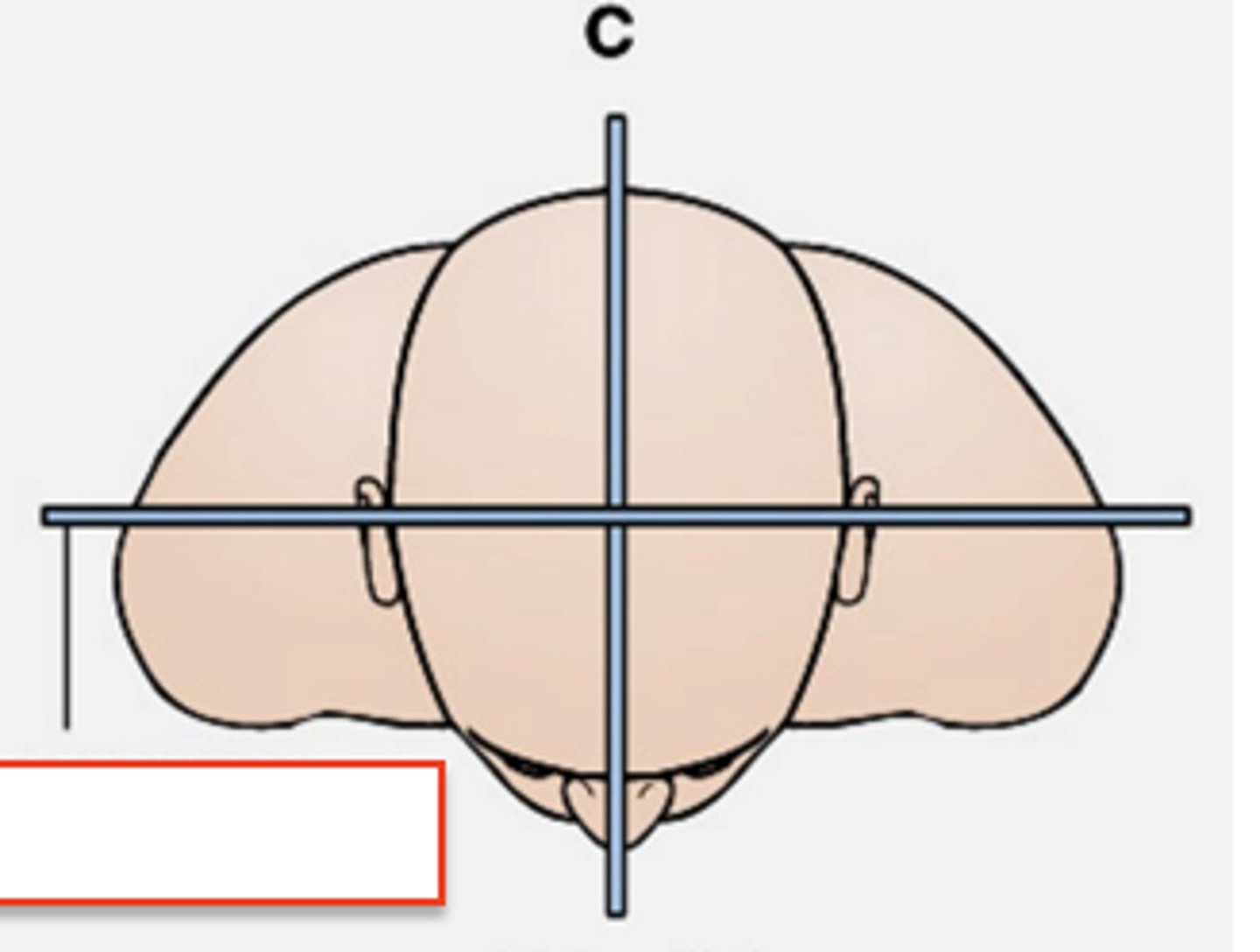 <p>plane perfectly divides the body front to back</p>