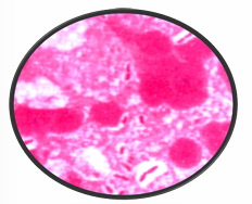 <p>What Bacterial Arrangement?</p>