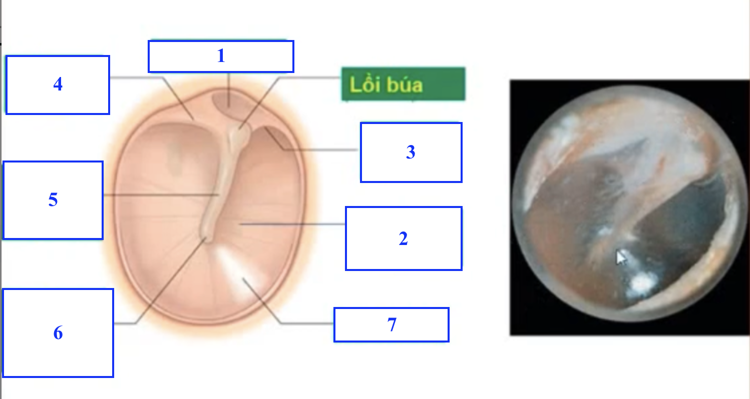 <p>Số 5 là chi tiết gì ?</p><p>Số 6 là chi tiết gì ?</p><p>Số 7 là chi tiết gì ?</p>