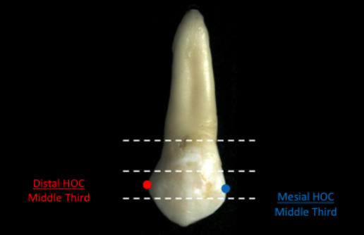 <p>middle 1/3</p>