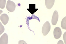 <p>Trypanosoma brucei is the agent that causes the disease African sleeping sickness. Observe a cell of this organism at the tip of the arrow in the photo of a blood smear below.  Is Trypanosoma brucei made up of a prokaryotic or a eukaryotic cell?   Identify feature(s) you observe in this cell to support your choice.</p>