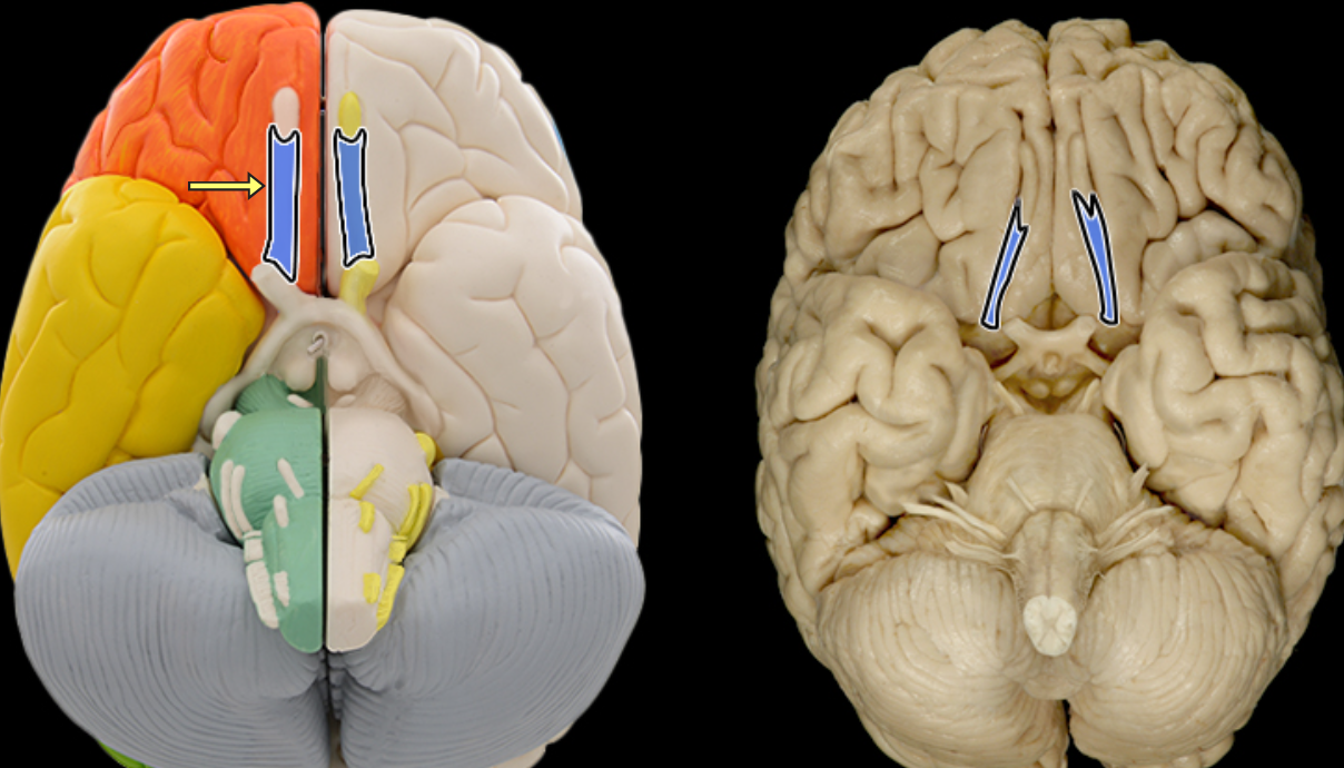 <p>Olfactory tract</p>