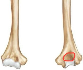 <p>humerus, big hole on the bottom backside</p>