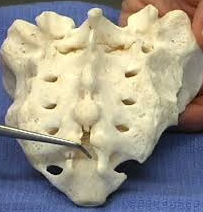 Opening at inferior end of sacrum on posterior side