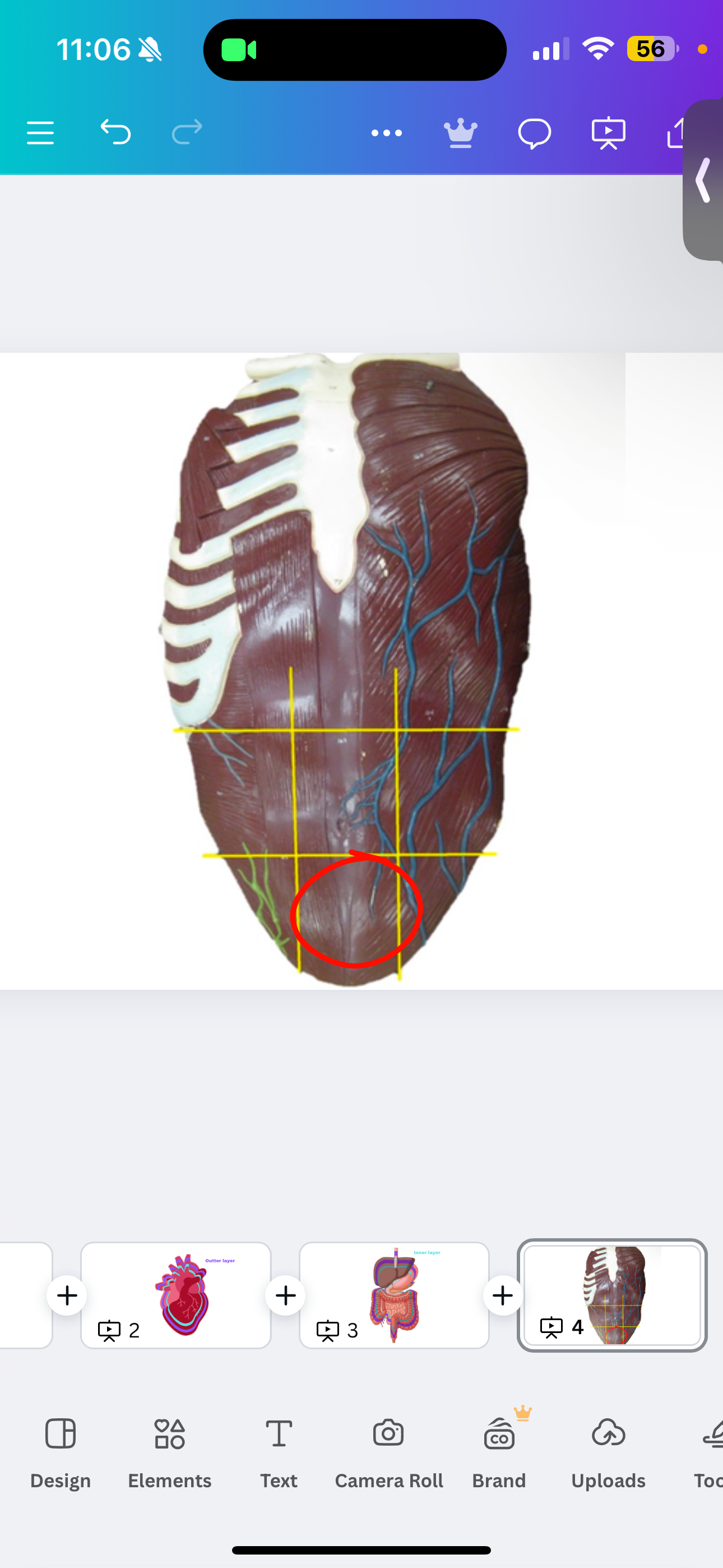 <p>Hypogastric region</p>