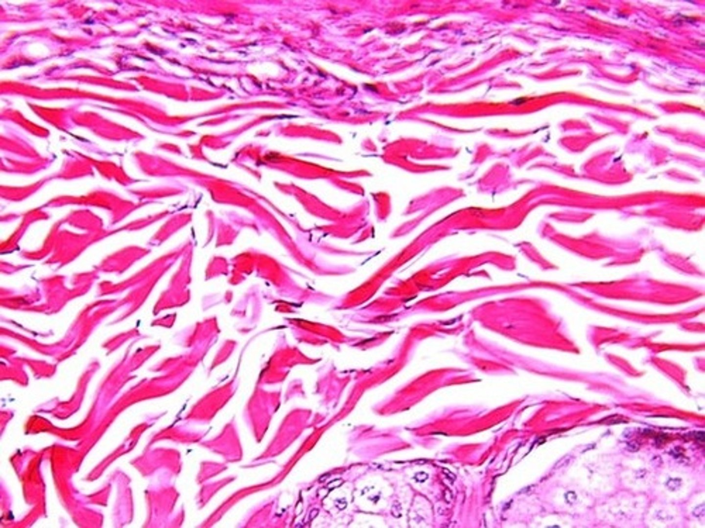 <p>dermis of skin</p>