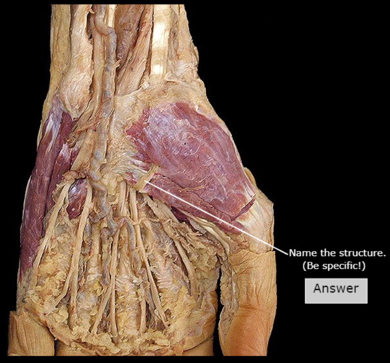 <p>What nerve is this</p>