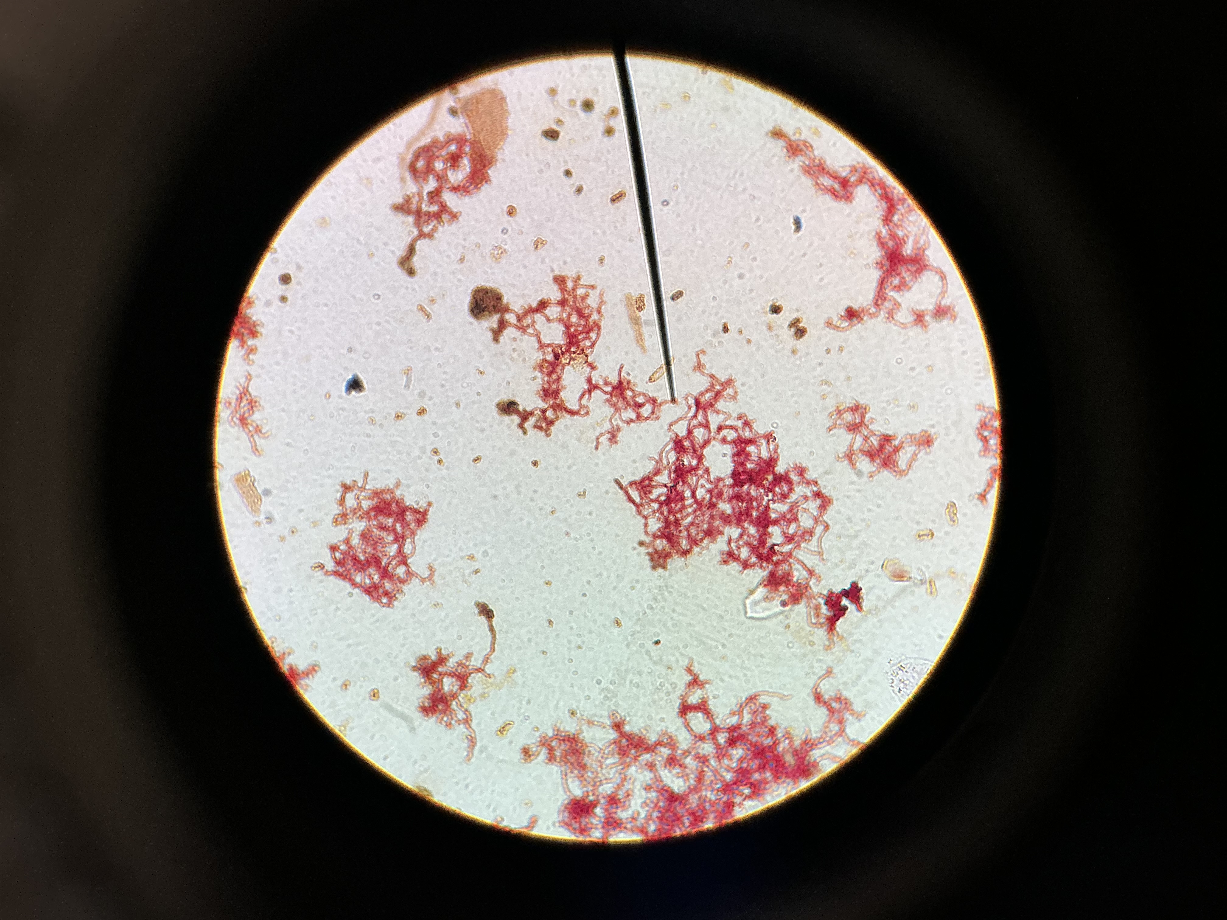 <p>T. pallidum</p>