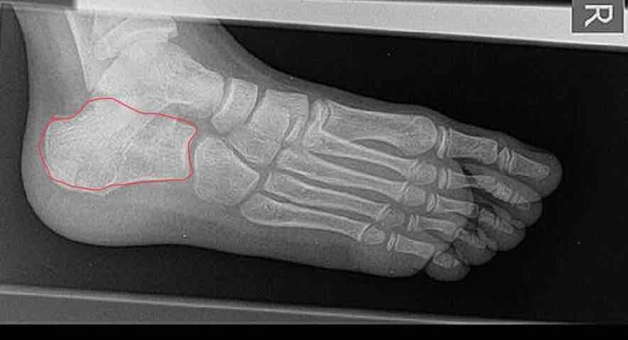 <p>Name this bone</p>