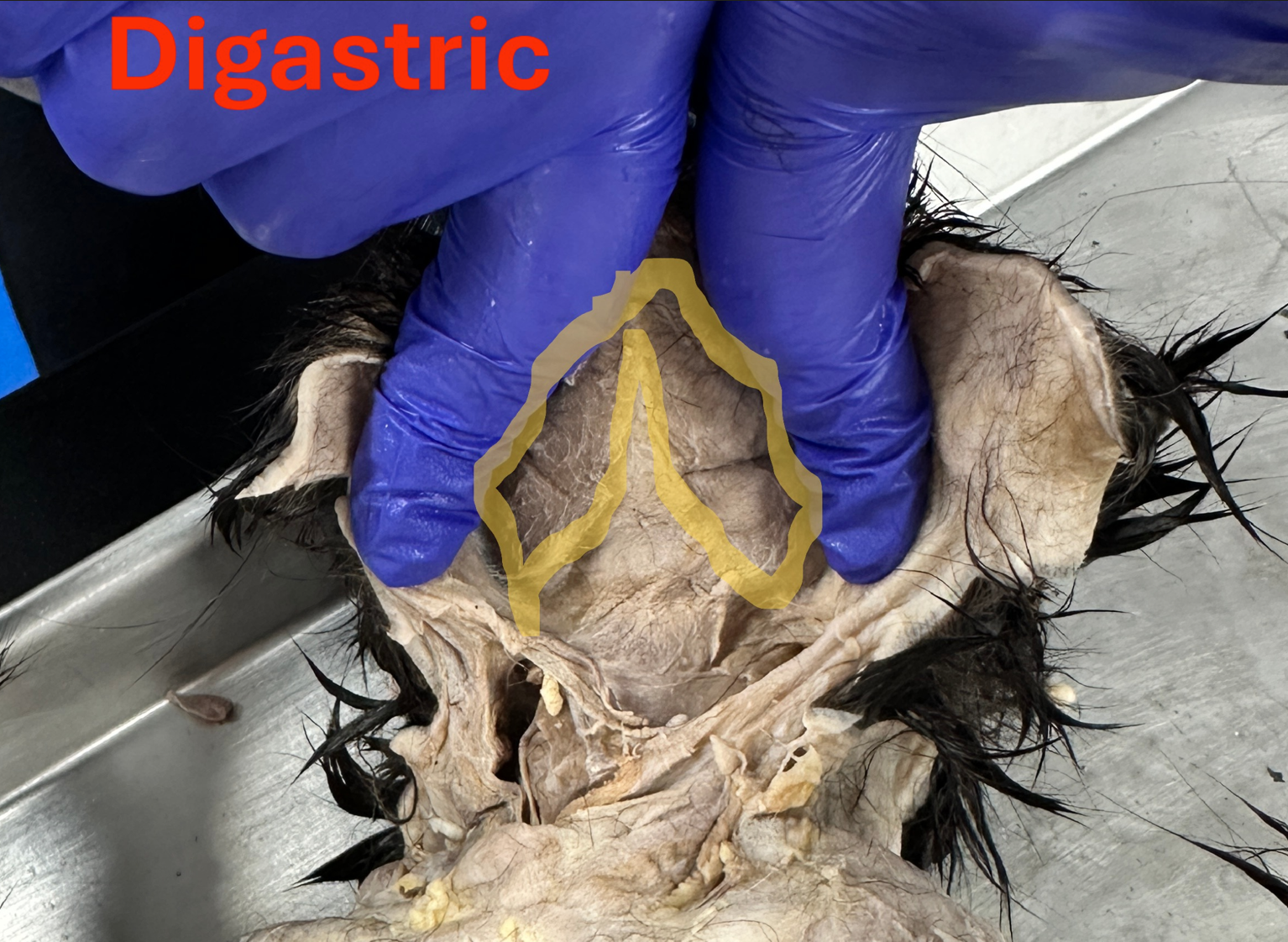 <p>Digastric (Neck muscles)</p>