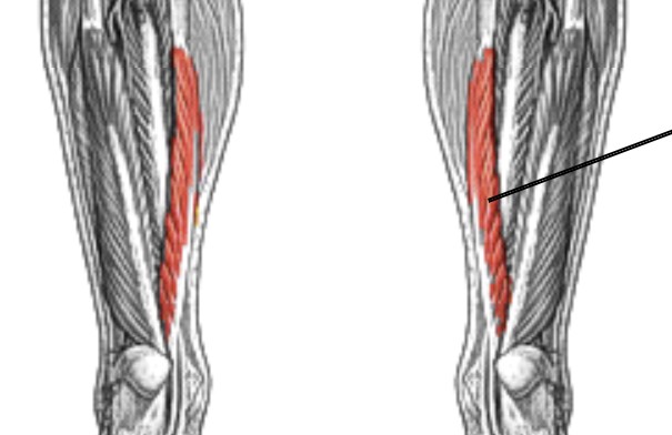 <p>Which muscle of the foot/ankle is:</p><ul><li><p>On posterior side</p></li><li><p>Medial to flexor hallucis longus</p></li><li><p>Action: flex 4 toes</p></li><li><p>Nerve: <span style="color: yellow;"><span>tibial</span></span></p></li></ul><p></p>