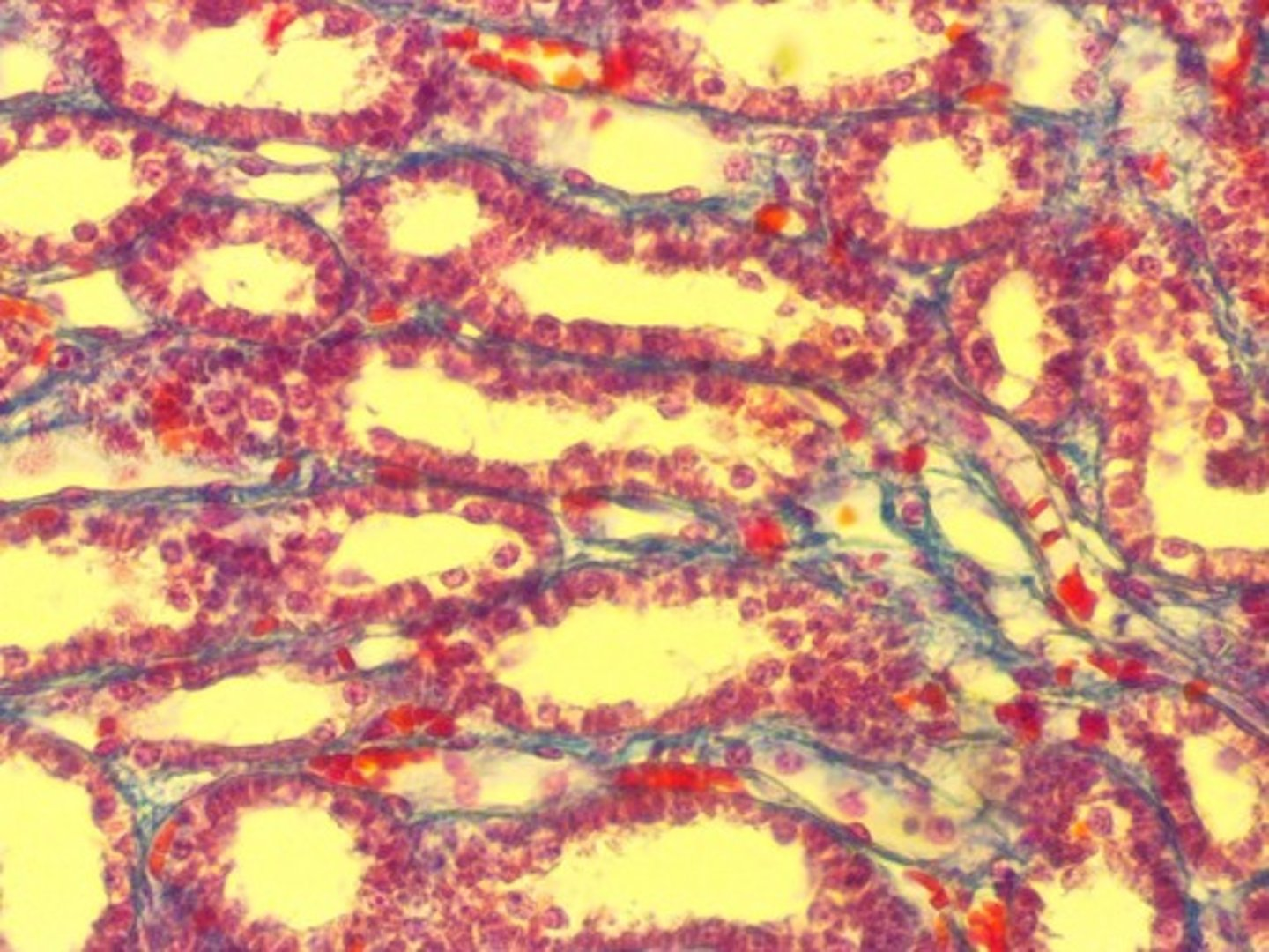 <p>What’s in this image? It was taken from the medulla of the kidney.</p>