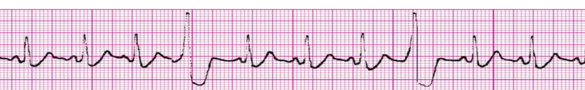 <p>What’s the rhythm?</p>