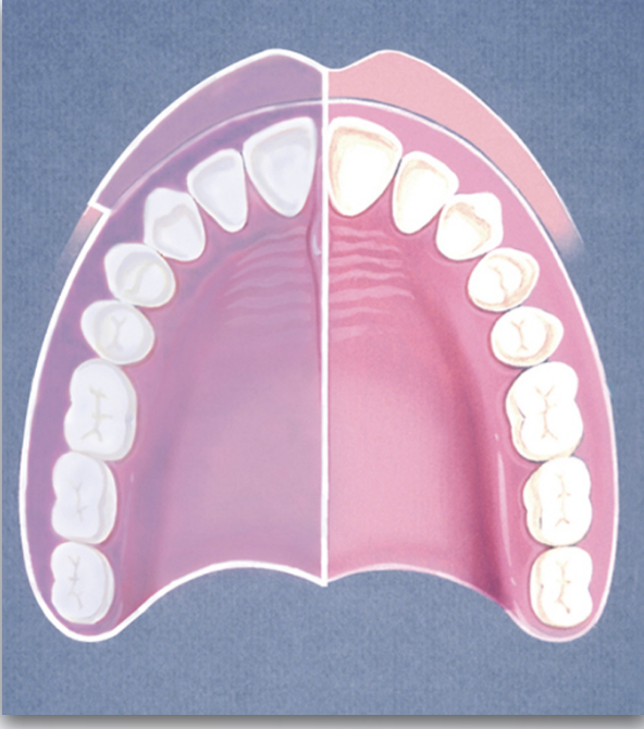 <p>what nerve block technique?</p>