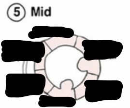 <p>Identify this image. </p>
