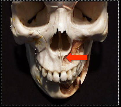 <p><span>A sharp bony projection of the maxilla located at the anterior and inferior portion of the nasal cavity.</span></p>