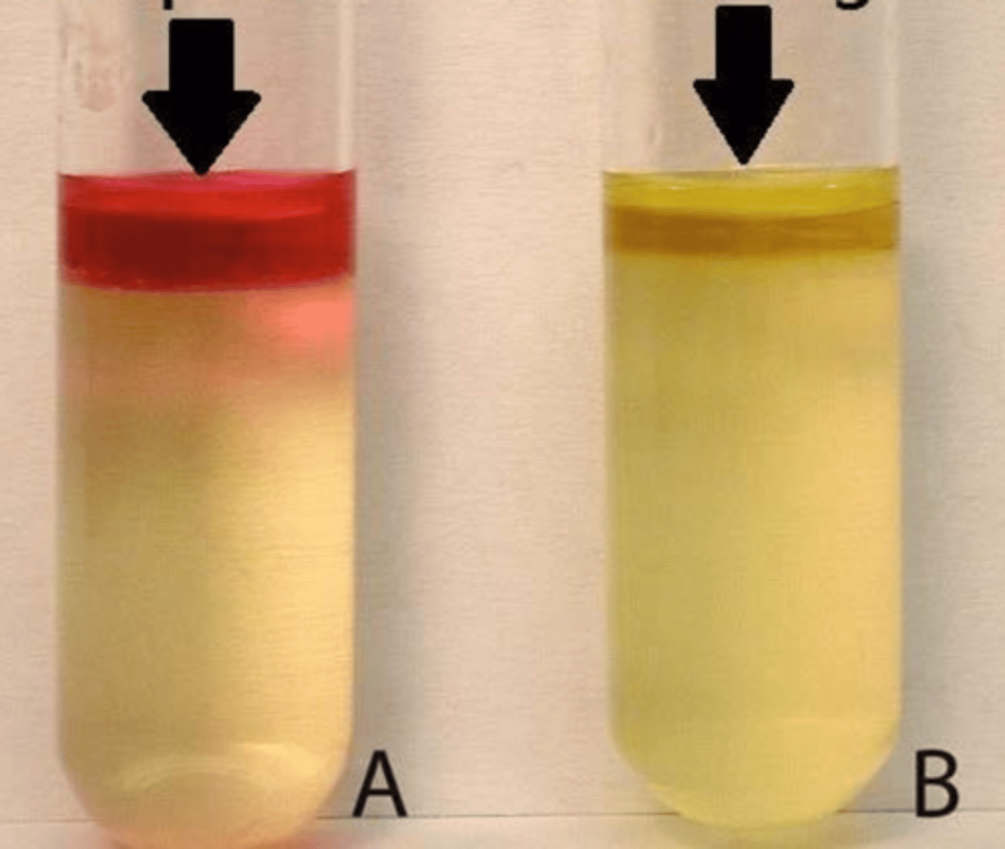 <p>which indole result does E. coli produce?</p>