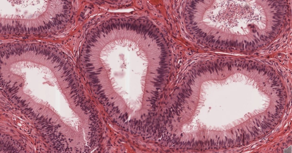 <p>Epitelio pseudoestratificado cilíndrico con microvellosidades largas</p>