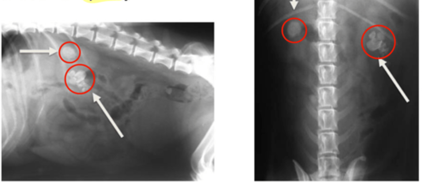 <p>Presence of renal calculi (stones)</p><p>Main radiographic finding is increased opacity</p>