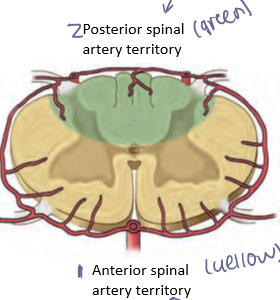<p>Paired arteries from the vertebral arteries/PICAs supplying the dorsal columns of the spinal cord (symptoms of problem- lose sensation)</p>