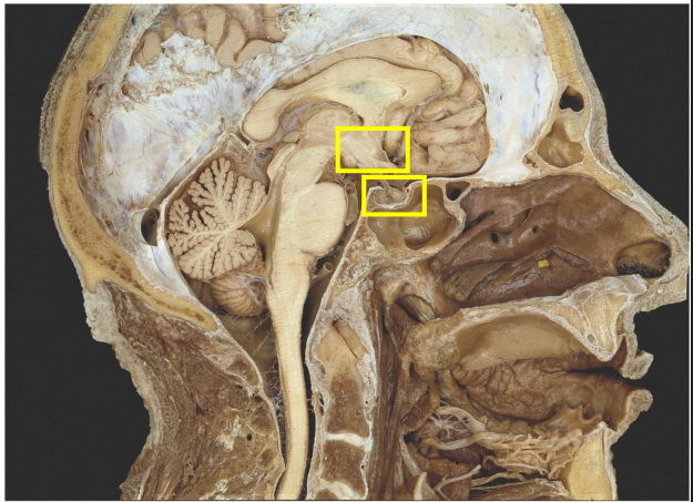 <p>- controls centre of ANS and controls the pituitary gland</p><p>- Lies inferior and anterior to the thalamus</p><p>- Secretes hormone-releasing factors which stimulate hormone release from anterior pituitary</p><p>- Secretes release-inhibiting factors to inhibit release from pituitary</p><p>- Connected to by the infundibulum</p><p>- NB: position of the pituitary gland in the pituitary fossa of the sphenoid bone</p>