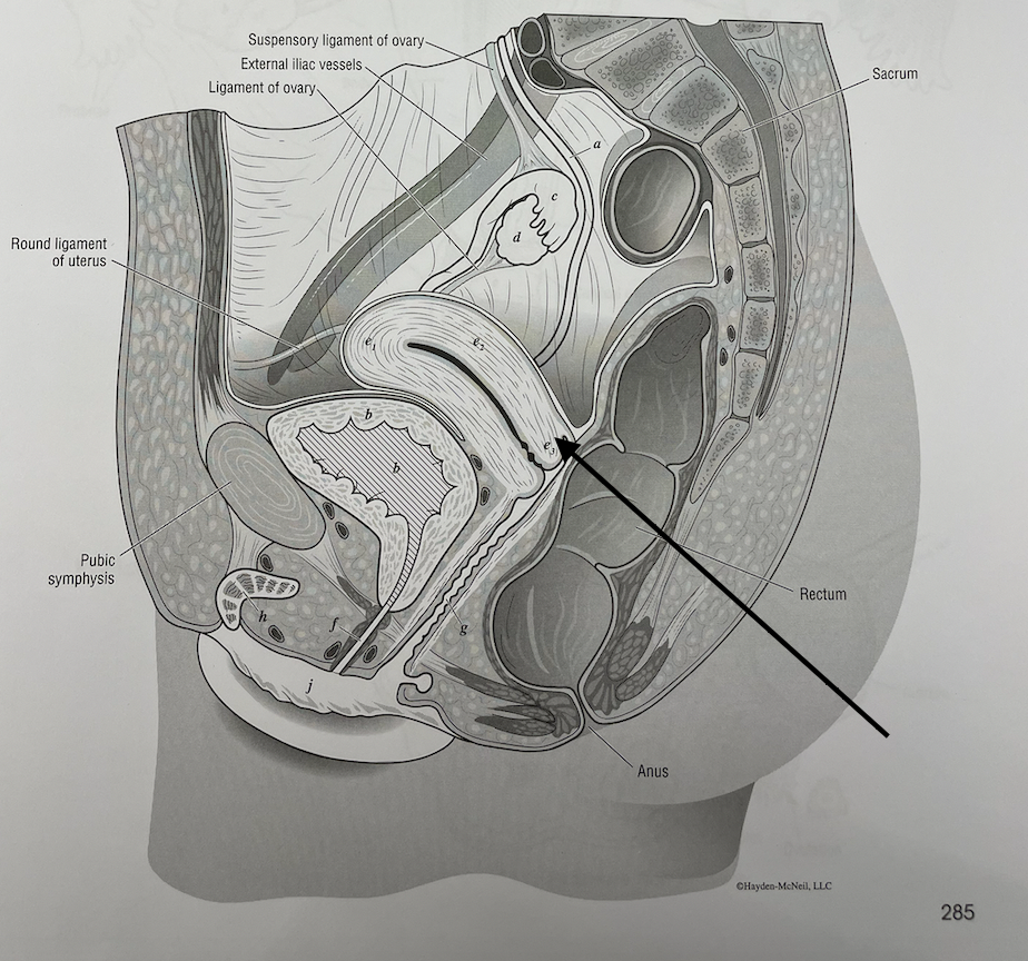 <p>what structure is this</p>