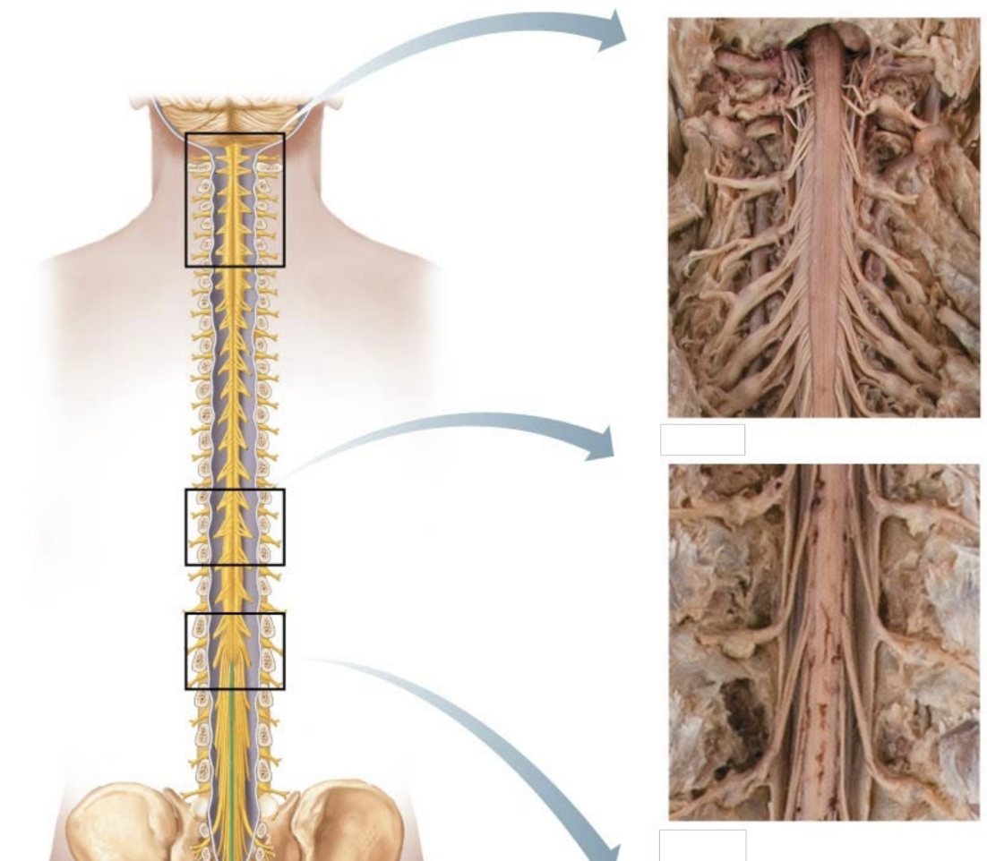 <ul><li><p>thickened regions of the spinal cord</p></li><li><p>additional neurons to supply limbs</p></li></ul><p></p>