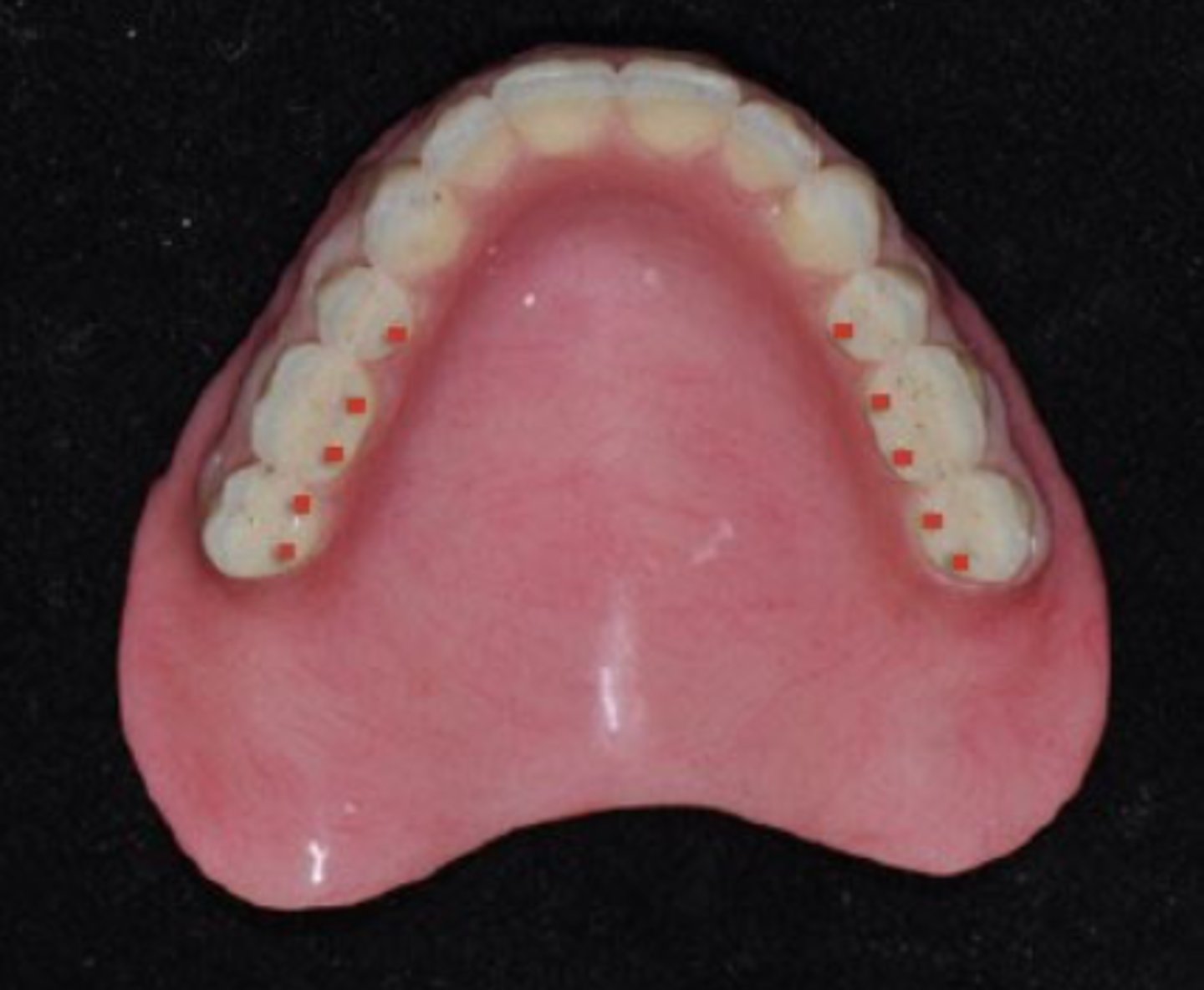 <p>Which type of BBO?</p>