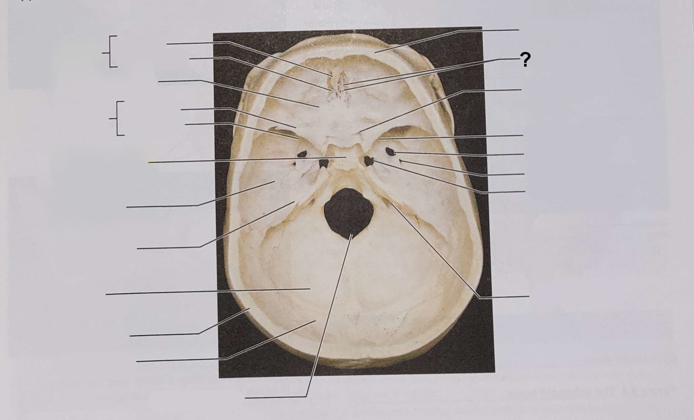 <p>Name the indicated structure</p>