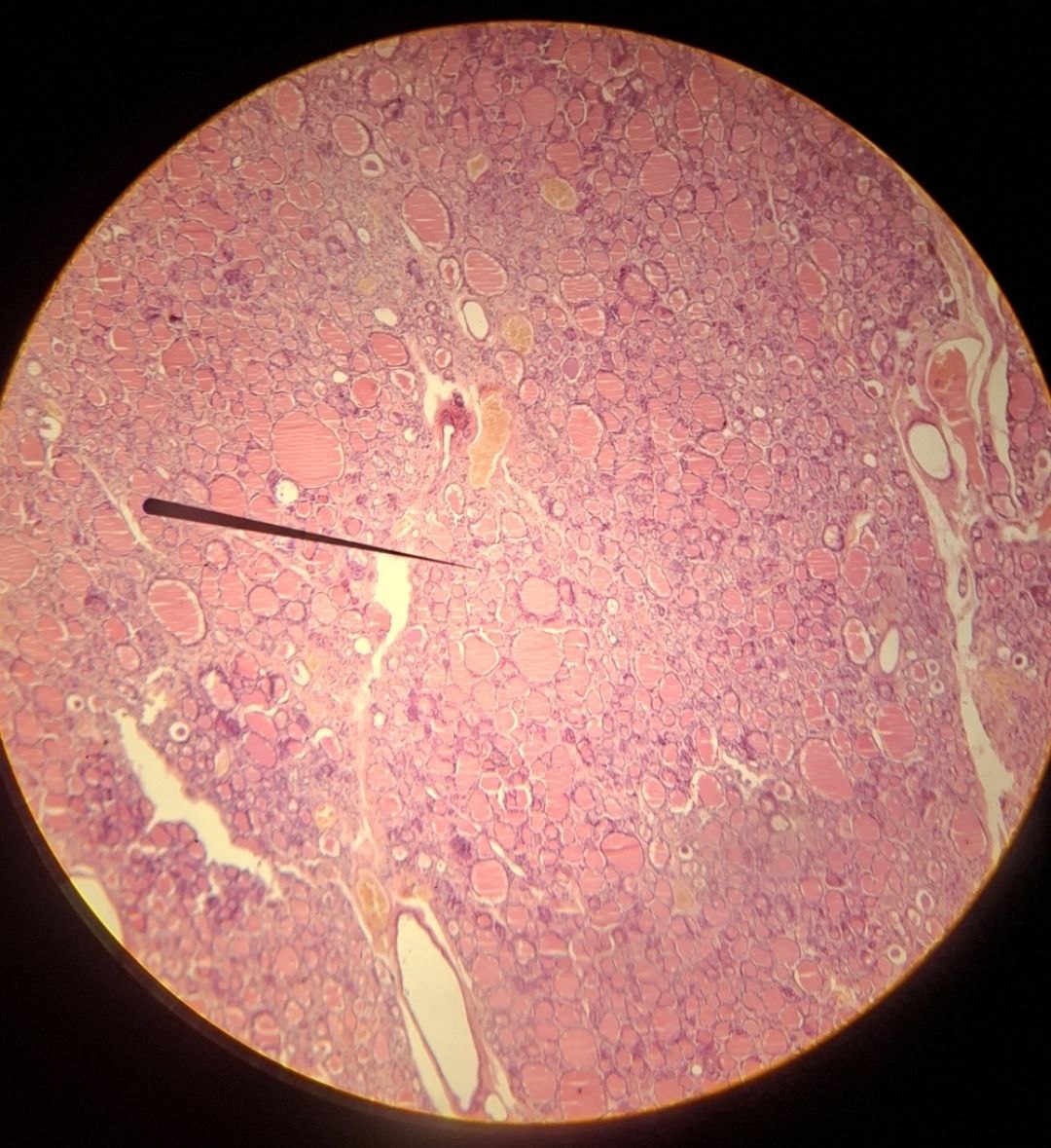 <p>Identify the tissue and mention one site</p>